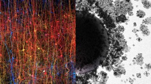 Nuestro Cerebro Funciona en 11 Dimensiones